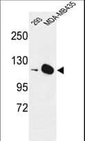 IHC-plus™ Polyclonal Rabbit anti-Human DIAPH2 Antibody (aa870-899, IHC, WB)