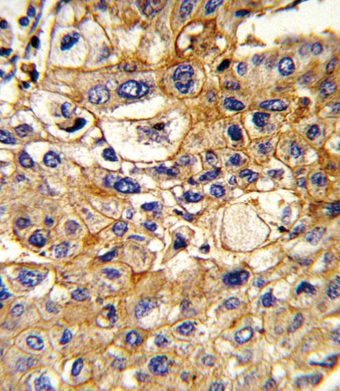 HLA-B Antibody (aa62-90)