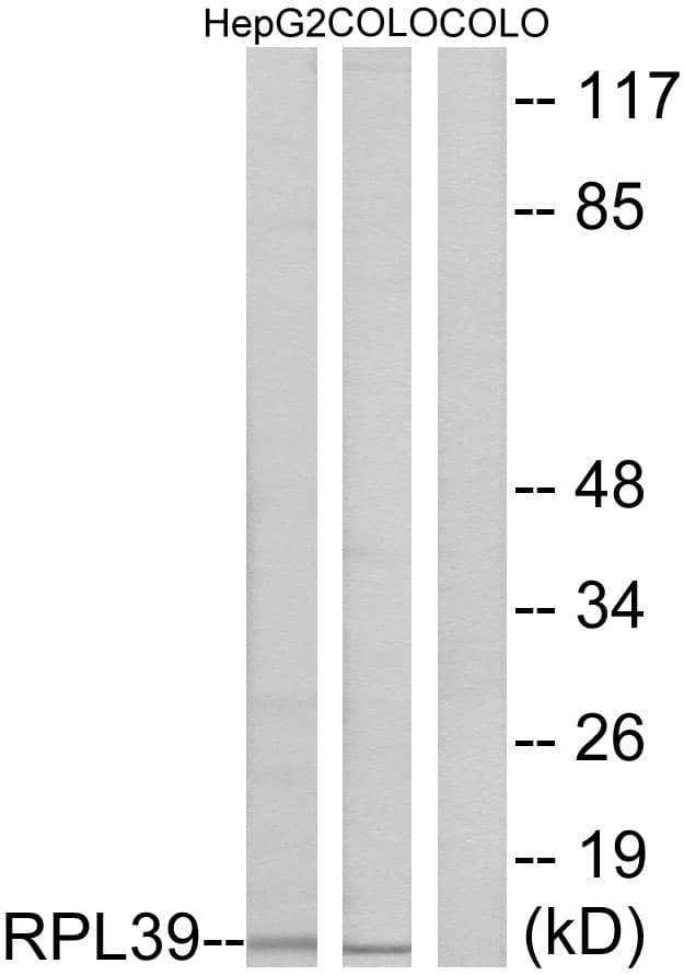 Polyclonal Rabbit anti-Human RPL39 / Ribosomal Protein L39 Antibody (aa1-50, IF, WB)