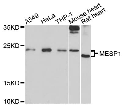 MESP1 Antibody