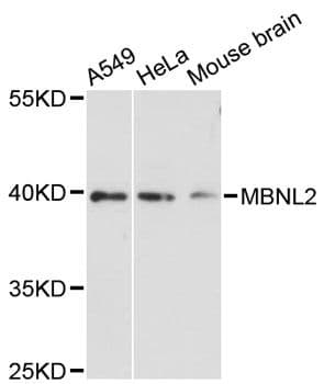 MBNL2 Antibody