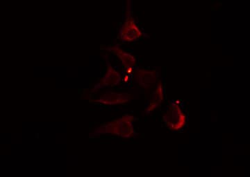 ACOT1 Antibody