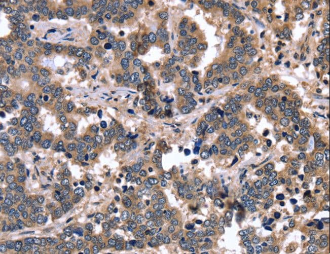 FGFR1OP2 Antibody