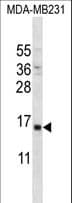 PTH / Parathyroid Hormone Antibody (aa59-88)