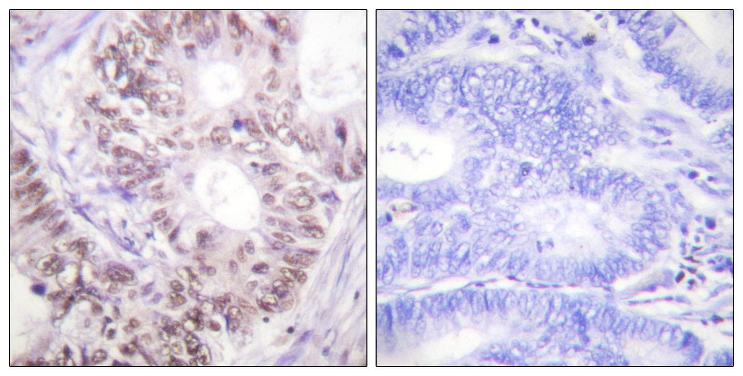 Polyclonal Rabbit anti-Human CDC25C Antibody (phospho-Thr48, IHC, WB)