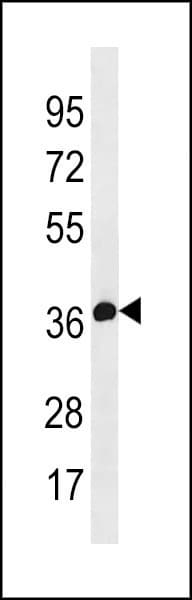 Polyclonal Rabbit anti-Human TEL-2 / ETV7 Antibody (aa313-341, WB)