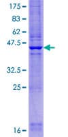 Human CYHR1 Protein (Recombinant GST)