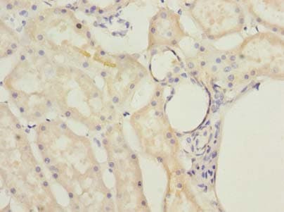 MRPL22 Antibody