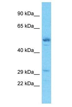 EXOSC3 Antibody (aa152-201)