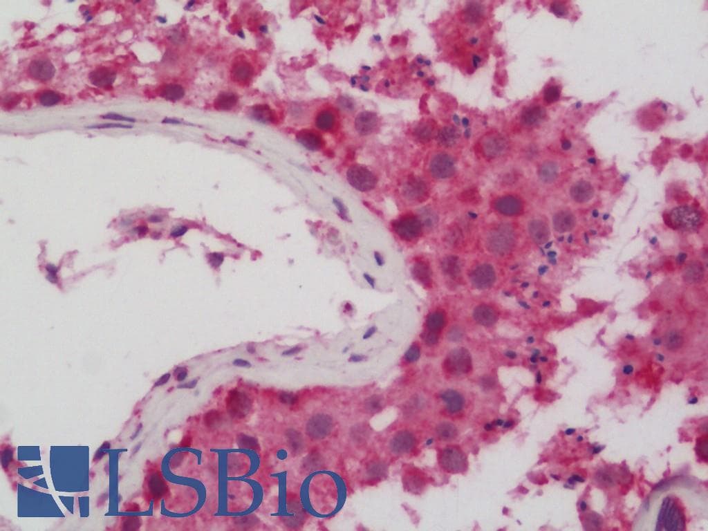 IHC-plus™ CYC1 / Cytochrome C-1 Antibody