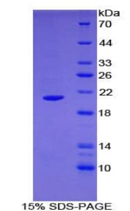 Human ARPC4 Protein (Recombinant His)