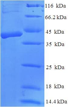 Human DKK2 Protein (Recombinant His-SUMO)