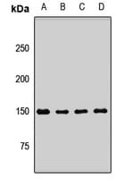 Polyclonal Rabbit anti-Human IKBKAP / IKAP Antibody (WB)