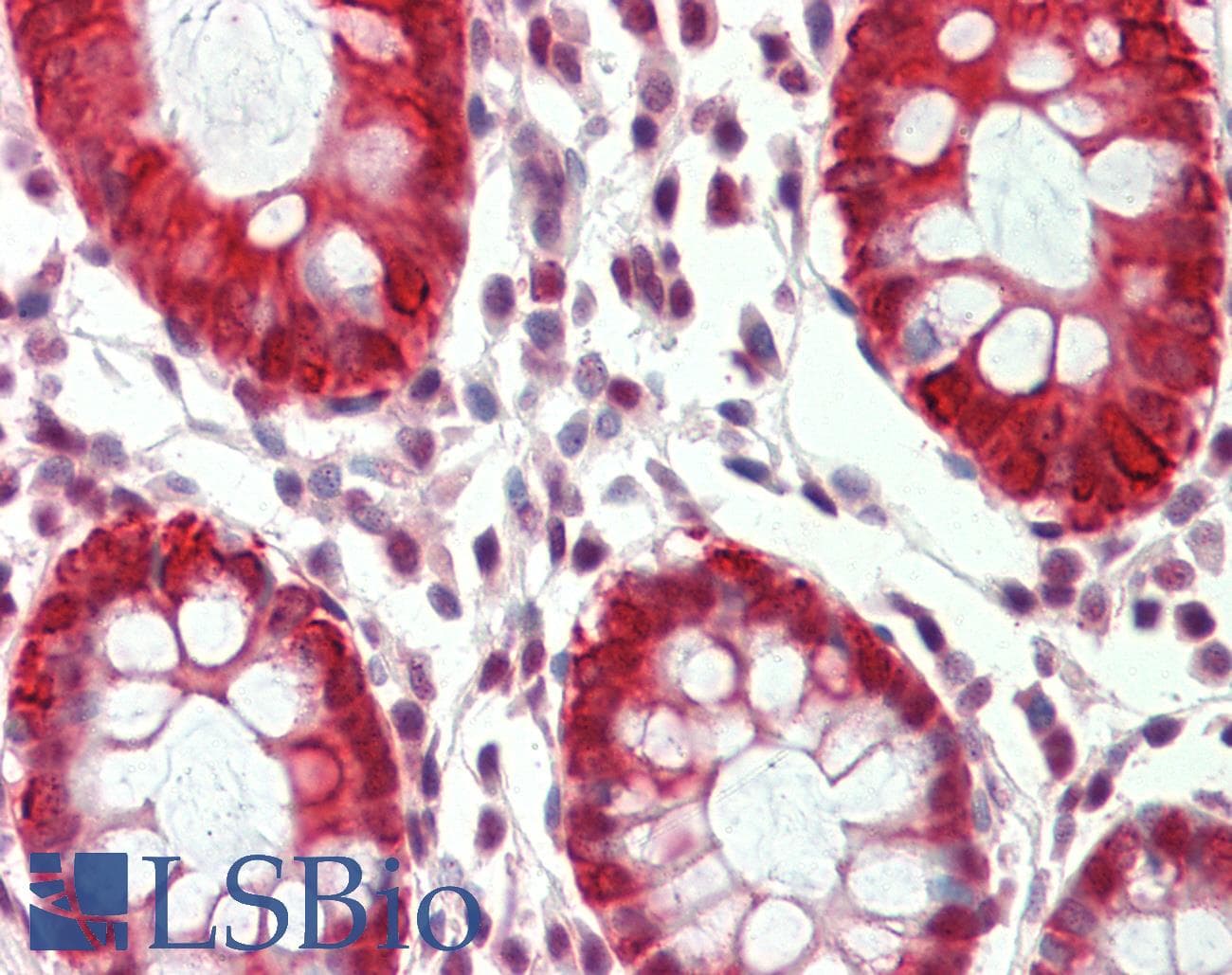 SAV1 / WW45 Antibody (aa266-315)