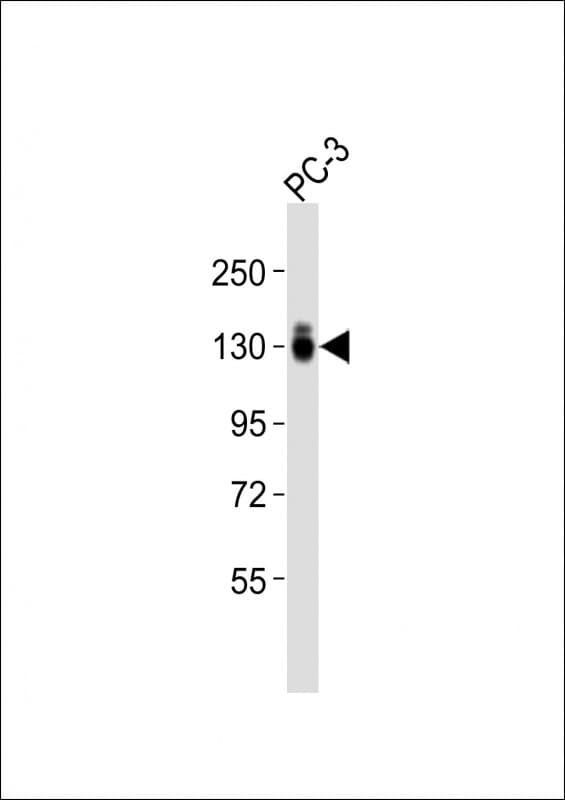 ITGA3 / CD49c Antibody (aa165-199)