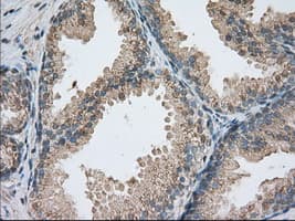 PDE4A / PDE4 Antibody (clone OTI6B6)