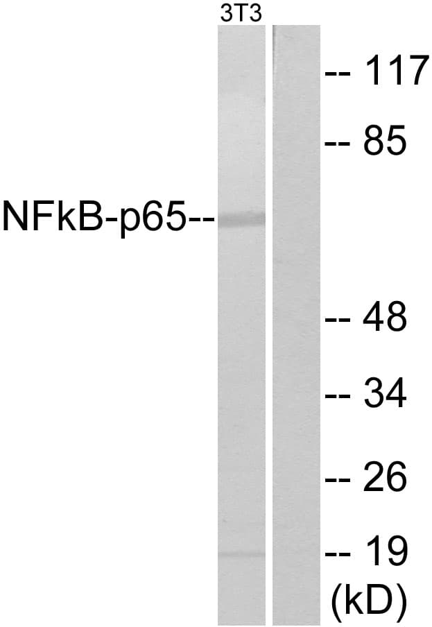 RELA / NFKB p65 Antibody (aa278-327)