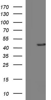 TXNDC5 / ERP46 Antibody (clone OTI1C3)