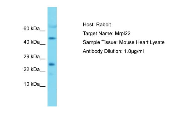 Polyclonal Rabbit anti-Mouse MRPL22 Antibody (aa91-140, WB)