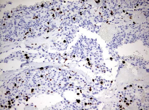 MKI67 / Ki67 Antibody (aa1160-1493, clone UMAB107, Carrier-free)