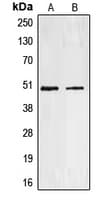 Polyclonal Rabbit anti-Human EDNRA / Endothelin A Receptor Antibody (C-Terminus, IHC, WB)