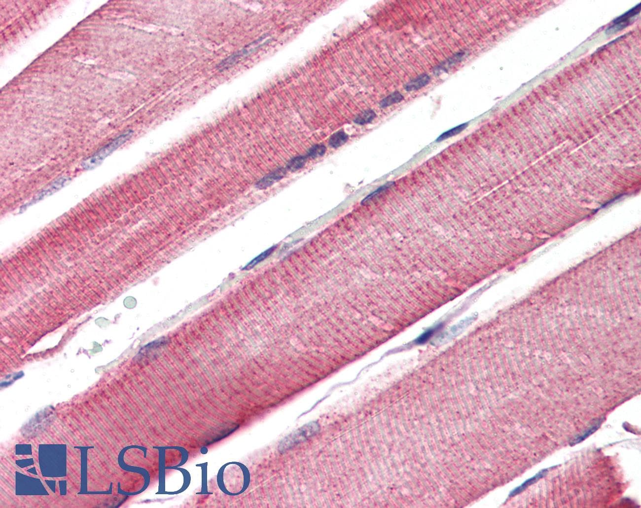 IHC-plus™ CPT1B Antibody (aa760-772)