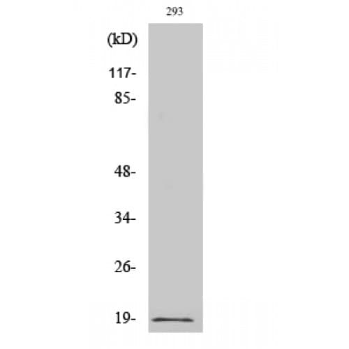 Polyclonal Rabbit anti-Human STMN1 / Stathmin / LAG Antibody (1-80 aa, IHC, IF, WB)
