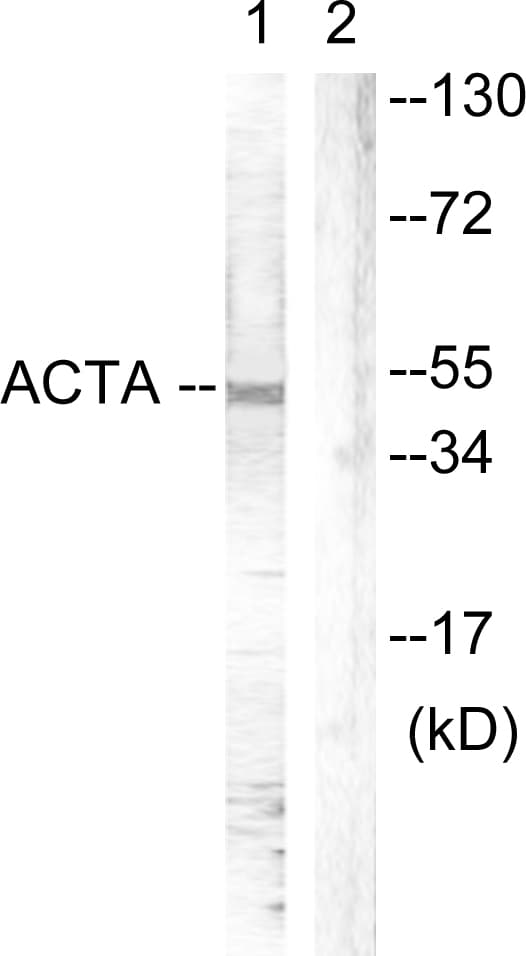 Actin Antibody (aa21-70)