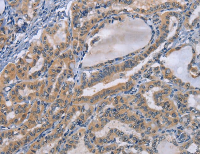 CD30 Antibody