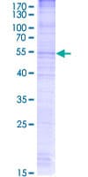 Human CKLF Protein (Recombinant GST)