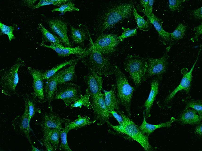 RIOK2 Antibody
