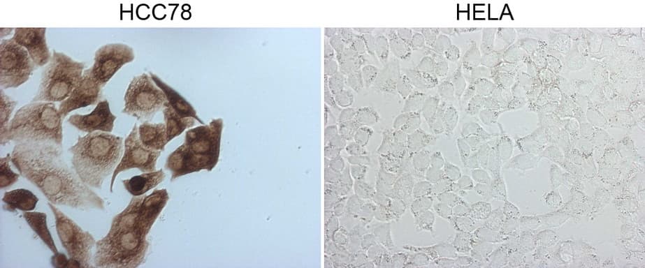 ROS1 / ROS Antibody (aa1882-2125, clone OTI1A1, Carrier-free)