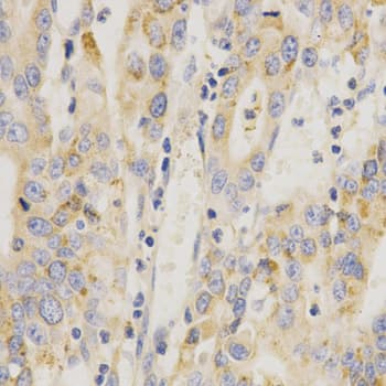 Polyclonal Rabbit anti-Human MAP2K6 / MEK6 / MKK6 Antibody (IHC, IF, WB)