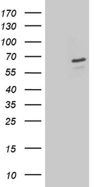 Monoclonal Mouse anti-Human DPYSL2 / CRMP2 Antibody (clone OTI2C9, aa13-490, WB)