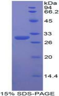 Human DNER / BET Protein (Recombinant His-T7)