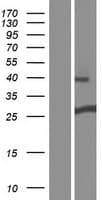 DGCR6 Protein (Over-Expression Lysate Myc-DDK (Flag))