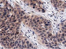 ACOT12 Antibody (clone OTI1A11)