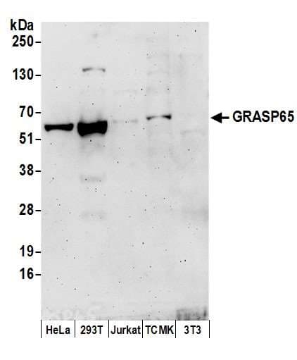 GORASP1 / GRASP65 Antibody (aa390-440)