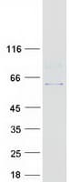 Human RGS7 Protein (Recombinant Myc-DDK (Flag))