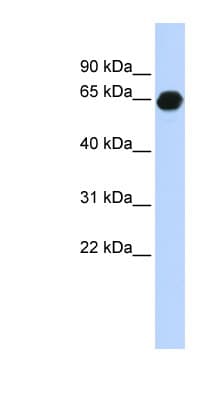 B3GALNT2 Antibody (aa216-265)