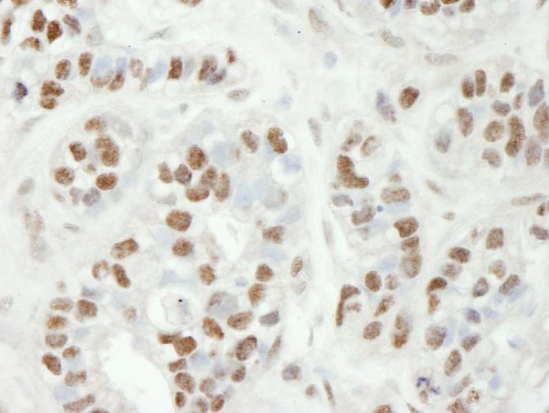 Polyclonal Rabbit anti-Human ZC3H11A Antibody (aa700-750, IHC)