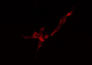 RPS4Y1 Antibody