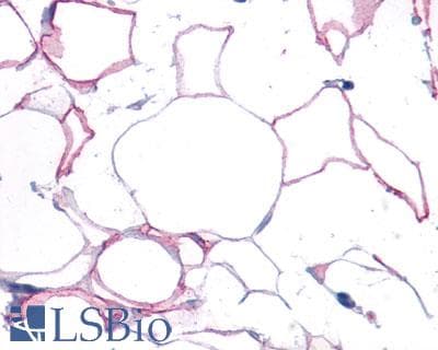 PathPlus™ Polyclonal Rabbit anti-Human FPR2 / FPRL1 Antibody (Extracellular Domain, IHC)