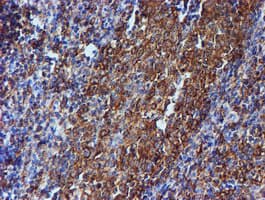 TUBB4 / Tubulin Beta 4 Antibody (clone OTI3F1, Carrier-free)
