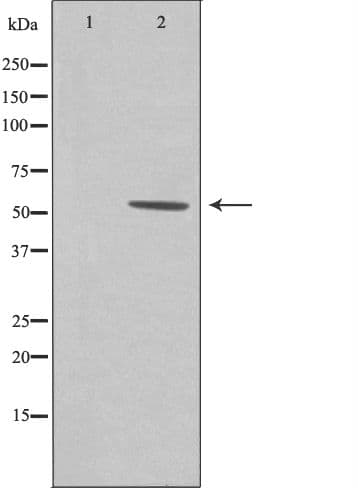 Polyclonal Rabbit anti-Human ZNHIT6 / C1orf181 Antibody (IF, WB)