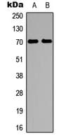 RPS6KB1 / P70S6K / S6K Antibody (Internal)