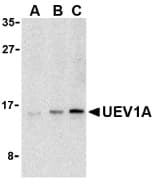 Polyclonal Rabbit anti-Human UEV1 / UEV1A Antibody (WB)