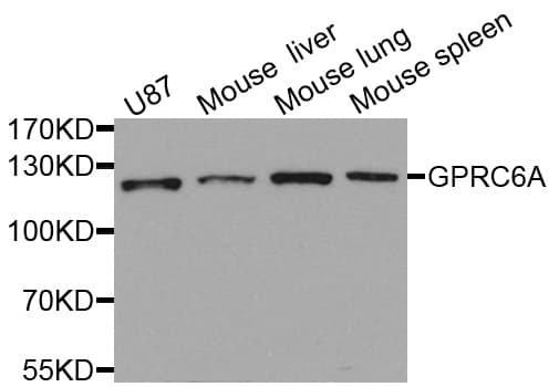 IHC-plus™ GPRC6A Antibody