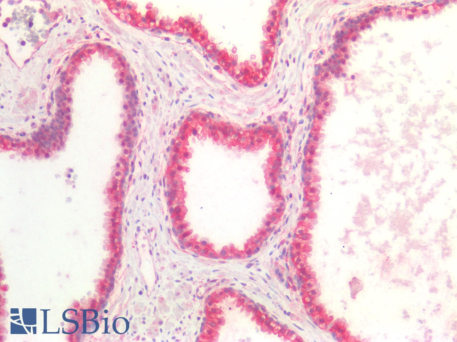 IHC-plus™ NTN1 / Netrin 1 Antibody