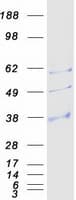 Human AQP9 / Aquaporin 9 Protein (Recombinant Myc-DDK (Flag))